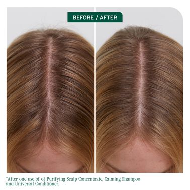 Matrix Biolage ScalpSync Purifying Scalp Concentrate 200ml NEW