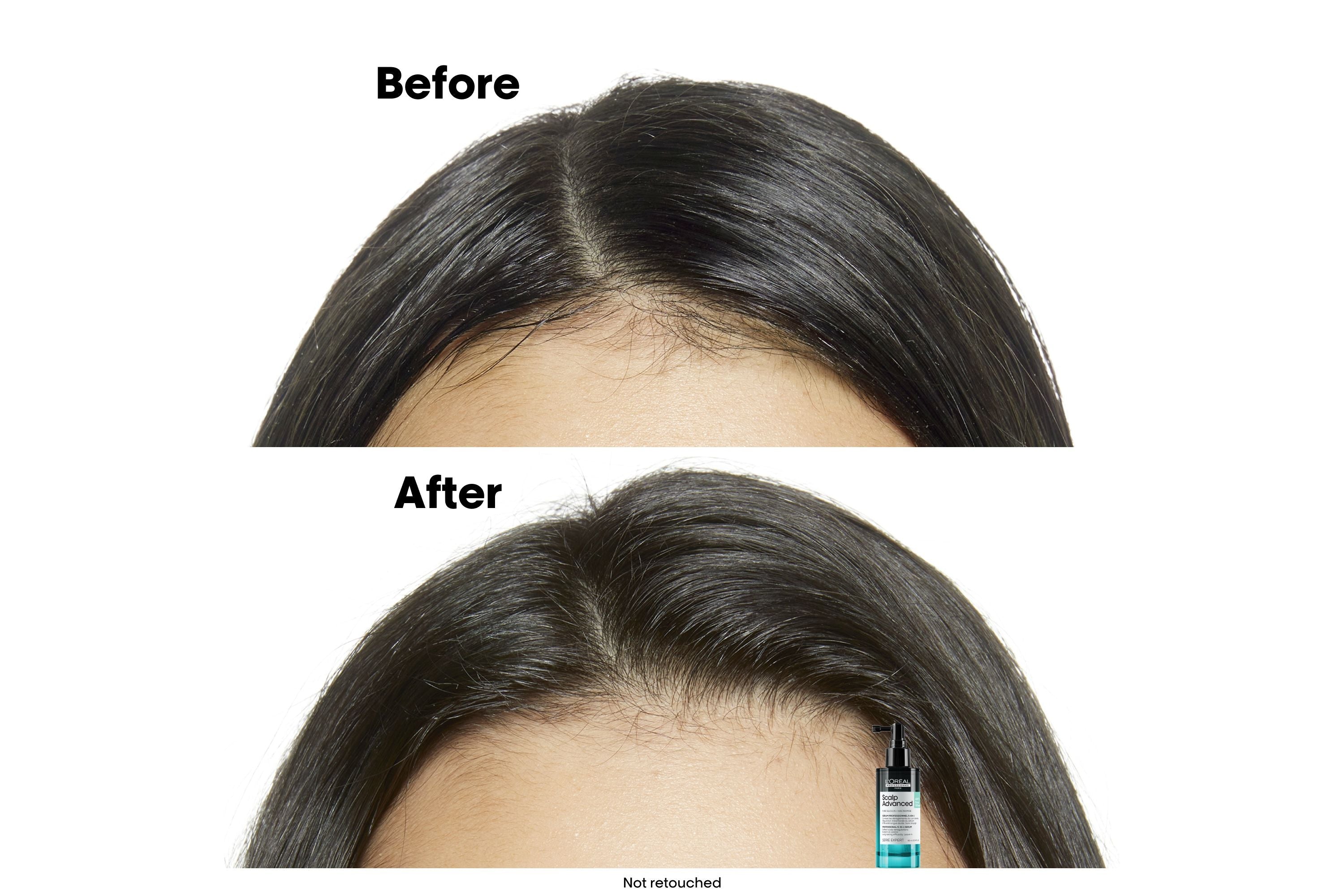 L'Oréal Professionnel Serie Expert Scalp Advanced Anti-Oiliness Serum 90ml - Salon Warehouse