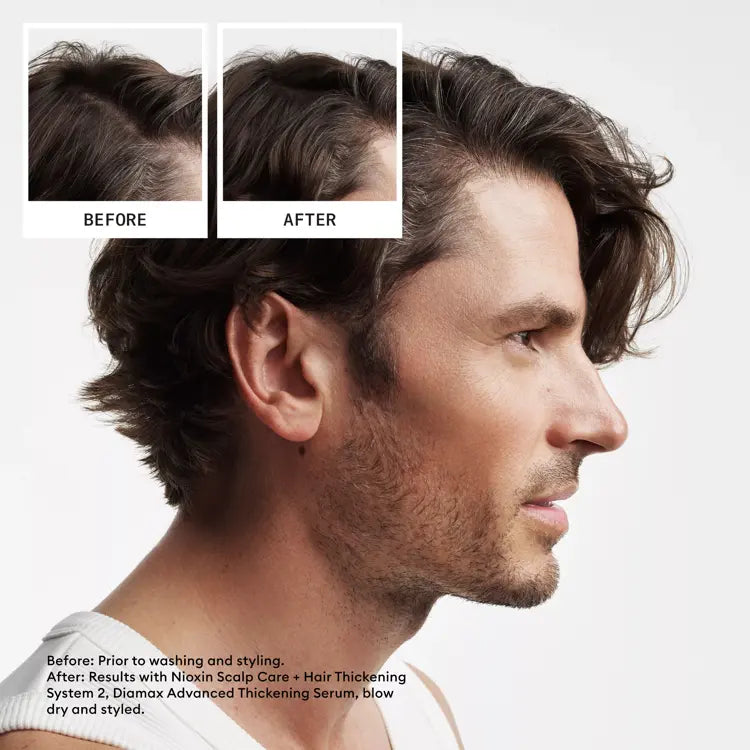 Nioxin PRO CLINICAL Hair Thickening System Kit 2